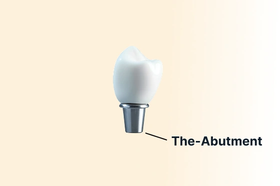 The Abutment