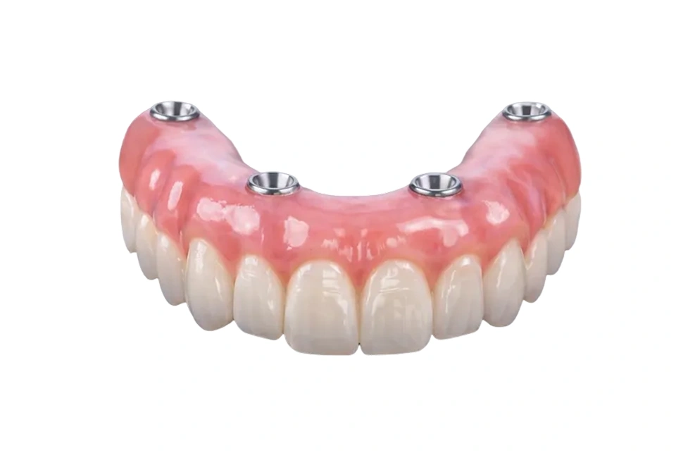 Full Mouth Dental Implants
