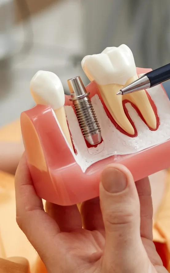 Customized Implant Treatment Options