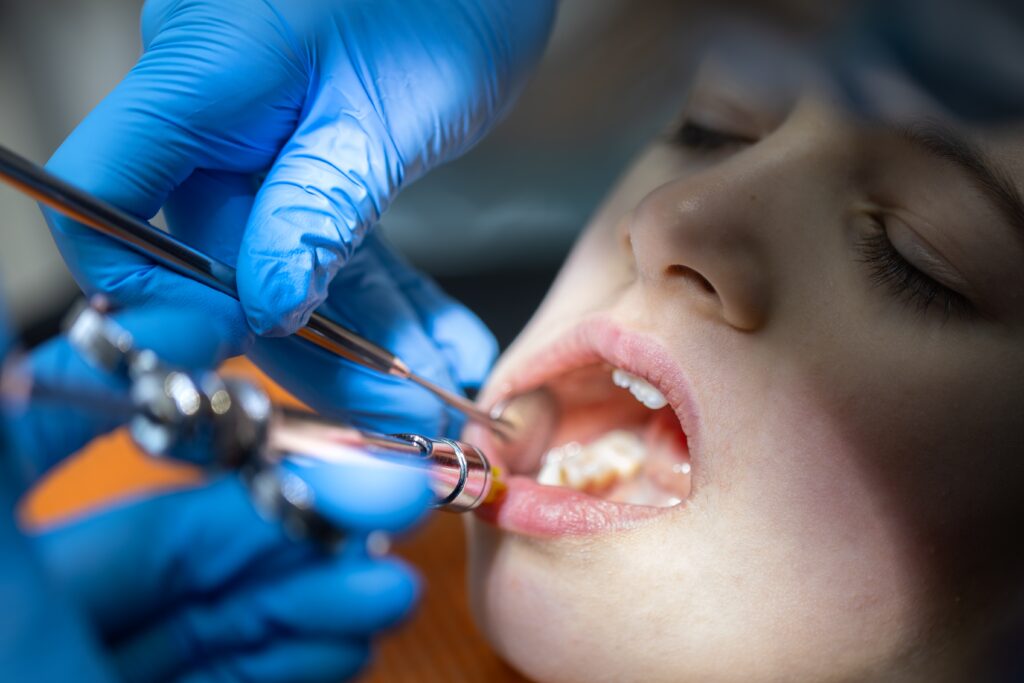 Dental Implants Mooresville